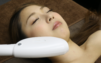 光フォトフェイシャル